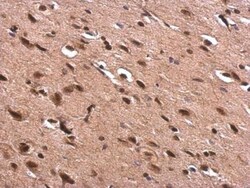 Acetylcholinesterase/ACHE Antibody, Novus Biologicals 0.1mg; Unlabeled:Antibodies,