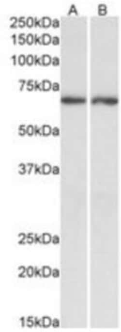 Acetylcholinesterase/ACHE Antibody, Novus Biologicals 0.1mg; Unlabeled:Antibodies,