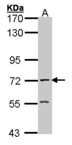 Acetylcholinesterase/ACHE Antibody, Novus Biologicals 0.1mg; Unlabeled:Antibodies,