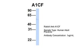 ACF Antibody, Novus Biologicals 100&mu;L; Unlabeled:Antibodies, Polyclonal