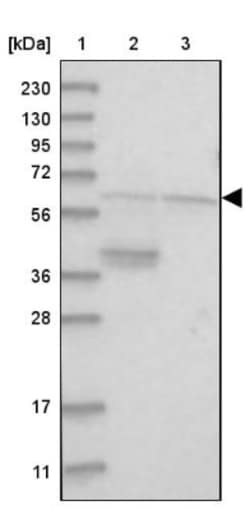 ACF Antibody, Novus Biologicals:Antibodies:Primary Antibodies