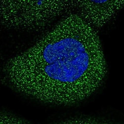 ACF Antibody, Novus Biologicals:Antibodies:Primary Antibodies