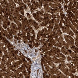 ACF Antibody, Novus Biologicals:Antibodies:Primary Antibodies