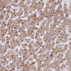 ACF Antibody, Novus Biologicals 0.1mL; Unlabeled:Antibodies, Polyclonal