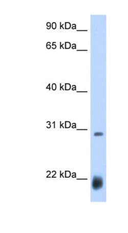 Achaete Antibody, Novus Biologicals 100&mu;L; Unlabeled:Antibodies, Polyclonal