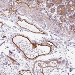 Acidic Calponin Antibody, Novus Biologicals 0.1mL; Unlabeled:Antibodies,