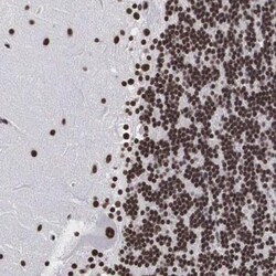 Acinus Antibody, Novus Biologicals 0.1mL; Unlabeled:Antibodies, Polyclonal