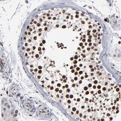ACF1 Antibody, Novus Biologicals 25 &mu;L; Unlabeled:Antibodies, Polyclonal