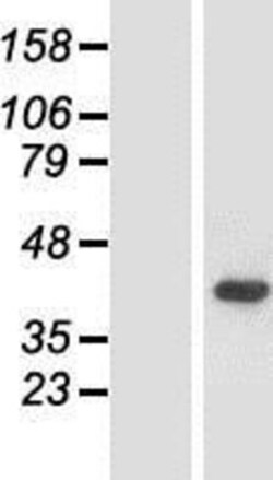 Novus Biologicals™ ACMSD Overexpression Lysate