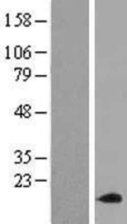 Novus Biologicals&trade;&nbsp;ACN9 Overexpression Lysate