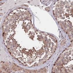 ACN9 Antibody, Novus Biologicals 0.1mL; Unlabeled:Antibodies, Polyclonal