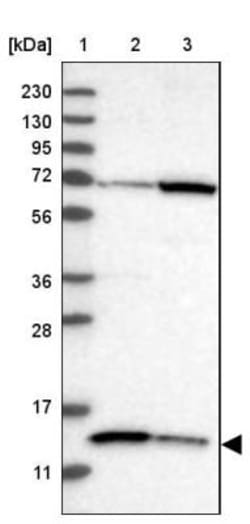 ACN9 Antibody, Novus Biologicals 0.1mL; Unlabeled:Antibodies, Polyclonal