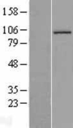 Novus Biologicals™ Aconitase 1 Overexpression Lysate