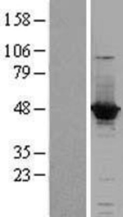Novus Biologicals&trade;&nbsp;ACOT1 Overexpression Lysate