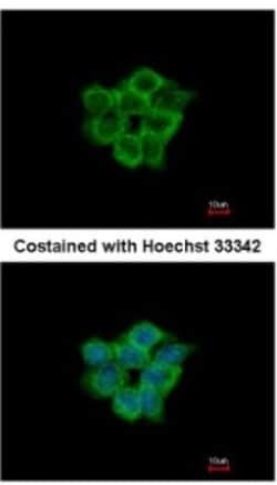 ACOT11 Antibody, Novus Biologicals 0.1mL; Unlabeled:Antibodies, Polyclonal