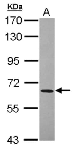 ACOT11 Antibody, Novus Biologicals 0.1mL; Unlabeled:Antibodies, Polyclonal