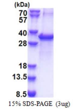 Novus Biologicals&trade;&nbsp;Recombinant Human ACOT11 His Protein