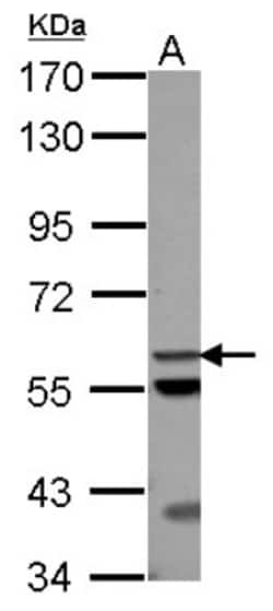 ACOT12 Antibody, Novus Biologicals 0.1mL; Unlabeled:Antibodies, Polyclonal