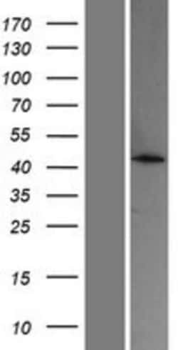 Novus Biologicals&trade;&nbsp;ACOT4 Overexpression Lysate