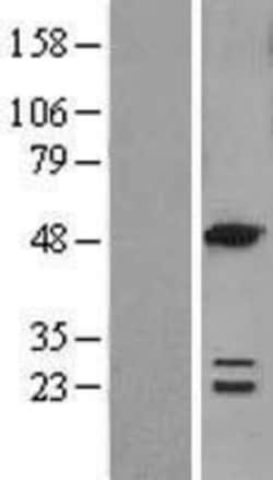 Novus Biologicals&trade;&nbsp;ACOT6 Overexpression Lysate