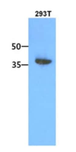 ACOT7 Antibody (1D5) - BSA Free, Novus Biologicals 0.1mL; Unlabeled:Antibodies,
