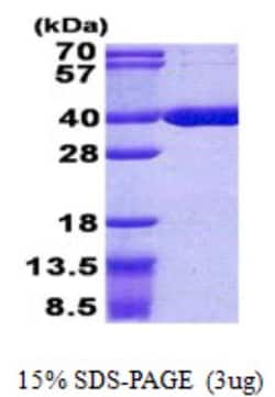 Novus Biologicals&trade;&nbsp;Recombinant Human ACOT8 His Protein