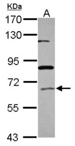 ACOX1 Antibody, Novus Biologicals 0.1 mL | Buy Online | Novus Biologicals | Fisher Scientific
