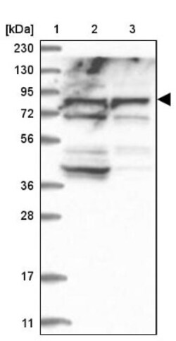 ACOX3 Antibody, Novus Biologicals:Antibodies:Primary Antibodies
