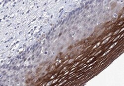 ACOX3 Antibody, Novus Biologicals:Antibodies:Primary Antibodies
