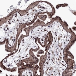 ACOX3 Antibody, Novus Biologicals:Antibodies:Primary Antibodies