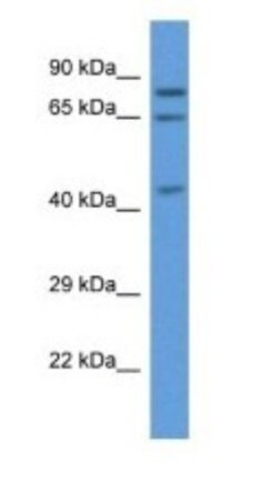 ACOX3 Antibody, Novus Biologicals:Antibodies:Primary Antibodies