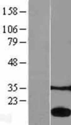 Novus Biologicals&trade;&nbsp;LMW-PTP/ACP1 Overexpression Lysate