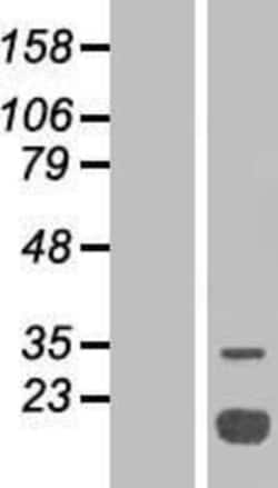 Novus Biologicals&trade;&nbsp;LMW-PTP/ACP1 Overexpression Lysate