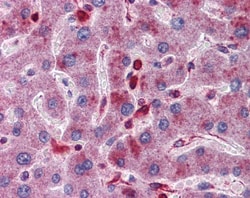 ACP2 Antibody, Novus Biologicals 100&mu;L; Unlabeled:Antibodies, Polyclonal