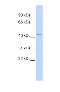 ACP2 Antibody, Novus Biologicals 100&mu;L; Unlabeled:Antibodies, Polyclonal