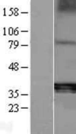 Novus Biologicals™ TRACP/PAP/ACP5 Overexpression Lysate