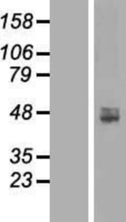 Novus Biologicals™ ACP6 Overexpression Lysate