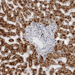 ACP6 Antibody, Novus Biologicals 25 &mu;L | Buy Online | Novus Biologicals | Fisher Scientific