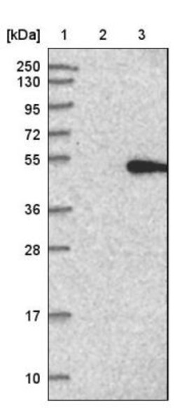 ACP6 Antibody, Novus Biologicals 25 &mu;L | Buy Online | Novus Biologicals | Fisher Scientific