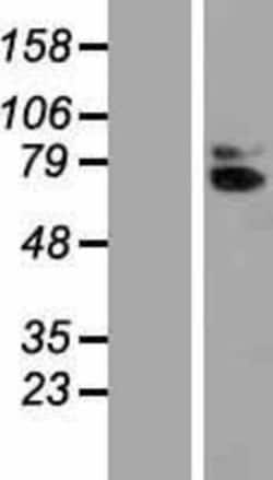 Novus Biologicals&trade;&nbsp;IL-18 R beta/IL-1 R7/ACPL Overexpression Lysate
