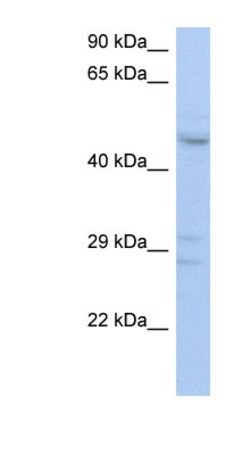 ACPL2 Antibody, Novus Biologicals 100&mu;L; Unlabeled:Antibodies, Polyclonal
