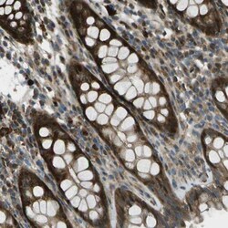ACPL2 Antibody, Novus Biologicals:Antibodies:Primary Antibodies