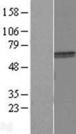 Novus Biologicals™ ACRBP Overexpression Lysate
