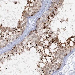 ACRBP Antibody, Novus Biologicals 0.1mL; Unlabeled:Antibodies, Polyclonal