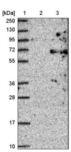 ACRBP Antibody, Novus Biologicals 0.1mL; Unlabeled:Antibodies, Polyclonal
