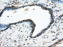 ACSBG1 Antibody (OTI1D8), Novus Biologicals 0.1mL; Unlabeled:Antibodies,