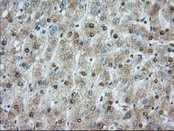 ACSBG1 Antibody (OTI1D8), Novus Biologicals 0.1mL; Unlabeled:Antibodies,
