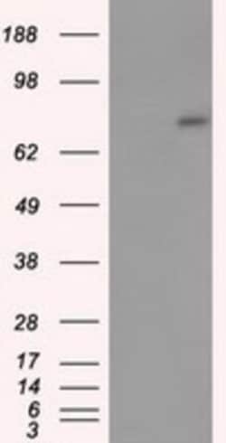 ACSBG1 Antibody (OTI1D8), Novus Biologicals 0.1mL; Unlabeled:Antibodies,