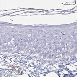 ACSBG2 Antibody, Novus Biologicals 25 &mu;L | Buy Online | Novus Biologicals | Fisher Scientific