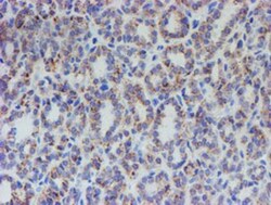ACSF2 Antibody (OTI6E4), Novus Biologicals 0.1 mL | Buy Online | Novus Biologicals | Fisher Scientific